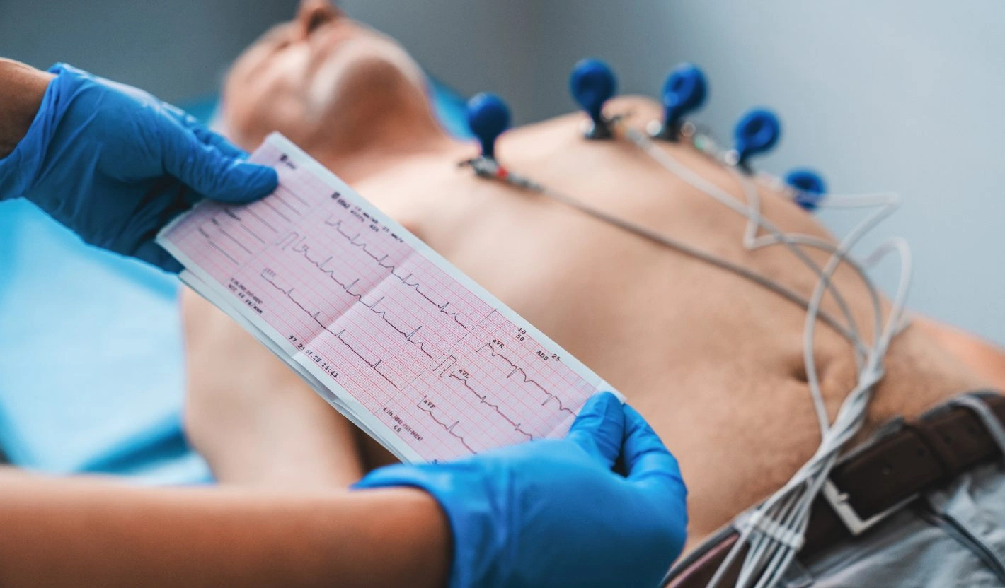 ECG Testing